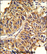 a05313 1 anti hmgcs1 antibody center ihc p testing 2