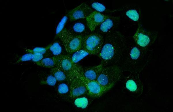 a05313 2 hmgcs1 primary antibodies if testing 10