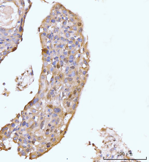 a05313 2 hmgcs1 primary antibodies ihc testing 2