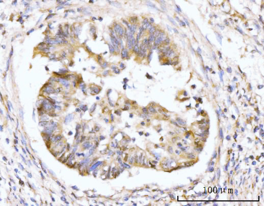 a05313 2 hmgcs1 primary antibodies ihc testing 4