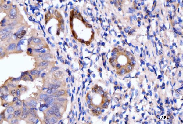 a05313 2 hmgcs1 primary antibodies ihc testing 5