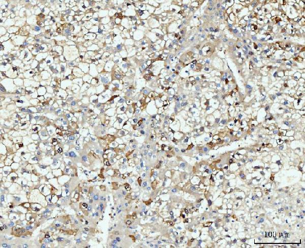 a05313 2 hmgcs1 primary antibodies ihc testing 6