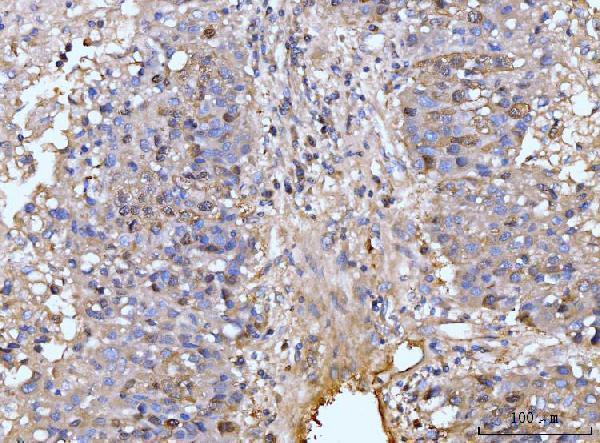 a05313 2 hmgcs1 primary antibodies ihc testing 7