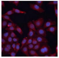 a05313 hmgcs1 primary antiboties if testing 2