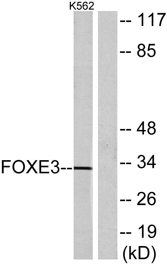 Western blot analysis of lysates from K562 cells, using FOXE3 Antibody