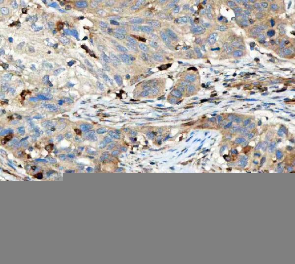  IHC analysis of TCR alpha/TRAC using anti-TCR alpha/TRAC antibody (A05315)