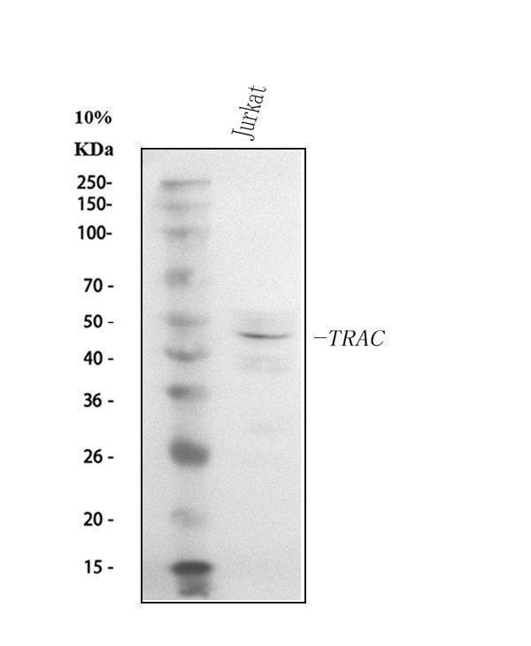  Western blot analysis of TCR alpha/TRAC using anti-TCR alpha/TRAC antibody (A05315)