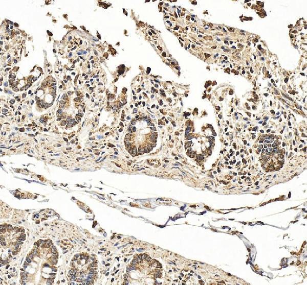 a05316 1 heph primary antibodies ihc testing 1