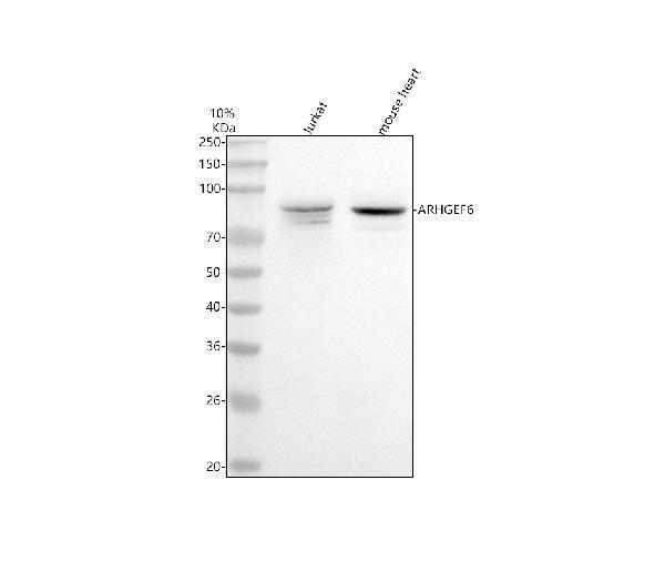  Western blot analysis of ARHGEF6 using anti-ARHGEF6 antibody (A05317-1)