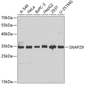 a05318 snap29 primary antiboties wb testing 1