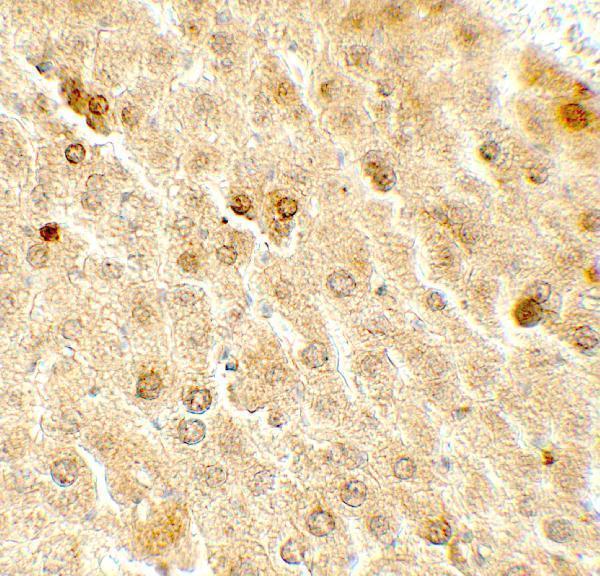 a05319 taf9 primary antibodies ihc testing 2