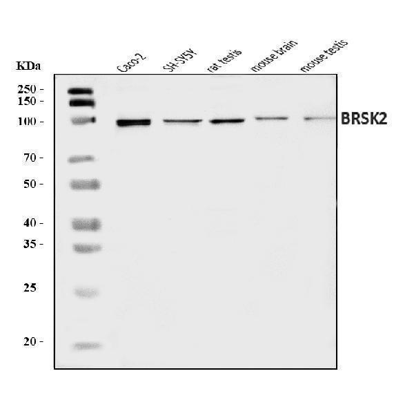  Western blot analysis of BRSK2 using anti-BRSK2 antibody (A05321-2)