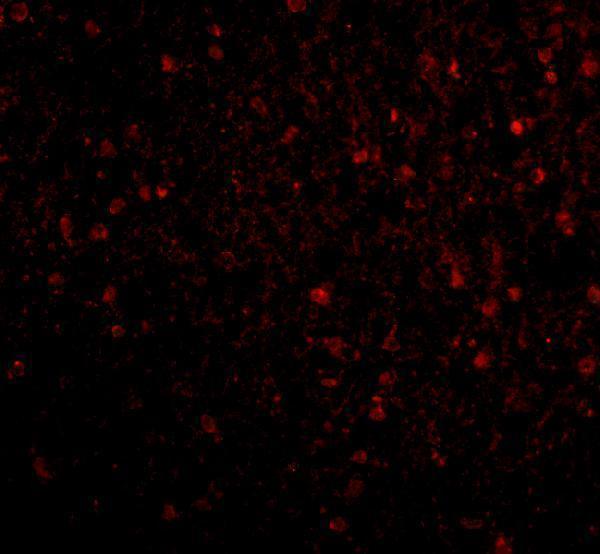 Immunofluorescence of BRSK2 in Human Brain cells with BRSK2 antibody at 20 μg/mL