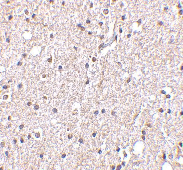 Immunohistochemistry of BRSK2 in human brain tissue with BRSK2 antibody at 5 μg/mL