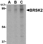 Western blot analysis of BRSK2 in human brain tissue lysate with BRSK2 antibody at (A) 0