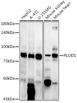 Western blot analysis of extracts of various cell lines, using PLOD1  antibody  at 1:1000 dilution