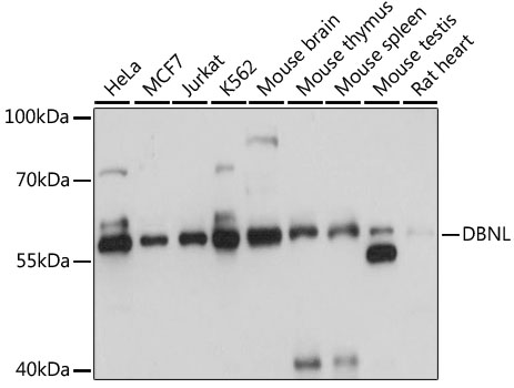 a05323 dbnl primary antiboties wb testing 1