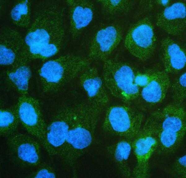 a05324 ckap5 primary antibodies if testing 6_1