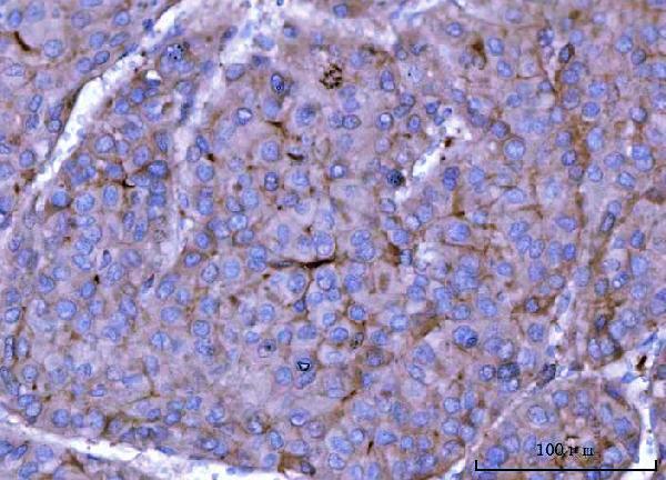 a05324 ckap5 primary antibodies ihc testing 2