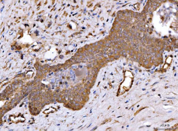 a05324 ckap5 primary antibodies ihc testing 3