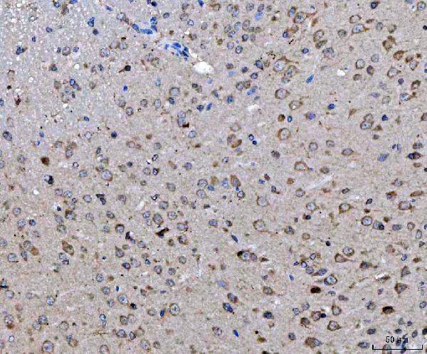 a05324 ckap5 primary antibodies ihc testing 4