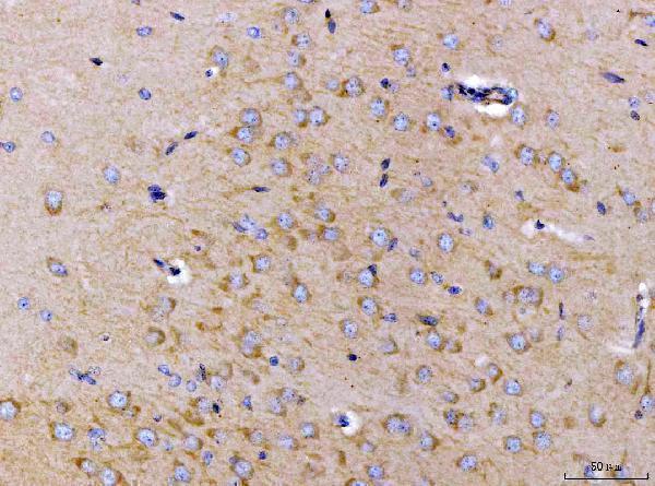 a05324 ckap5 primary antibodies ihc testing 5