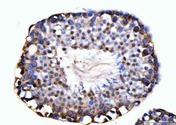 a05325 1 kifc1 primary antibodies ihc testing 12