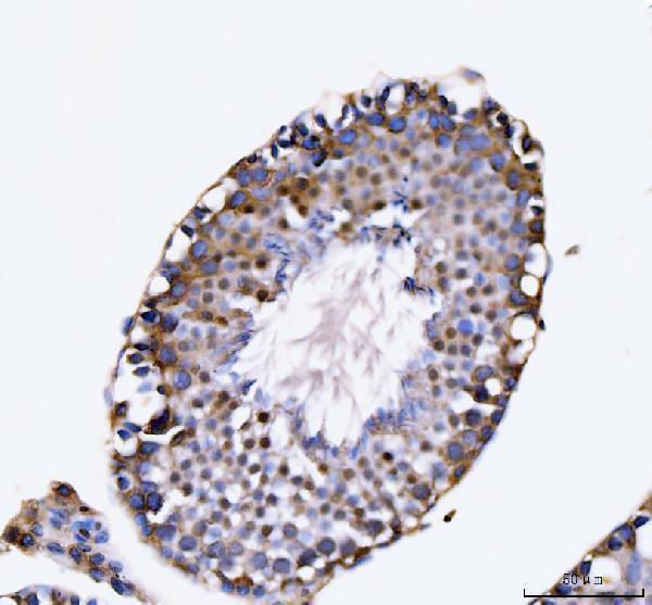 a05325 1 kifc1 primary antibodies ihc testing 2