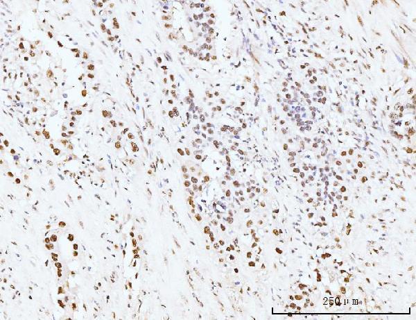 a05325 1 kifc1 primary antibodies ihc testing 3