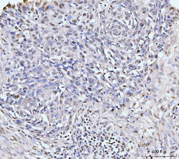 a05325 1 kifc1 primary antibodies ihc testing 4