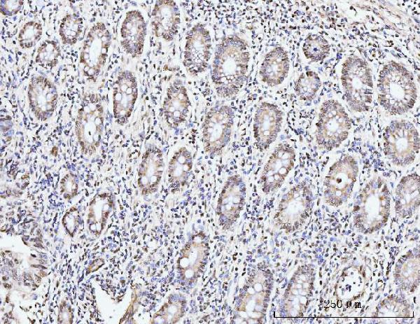 a05325 1 kifc1 primary antibodies ihc testing 5