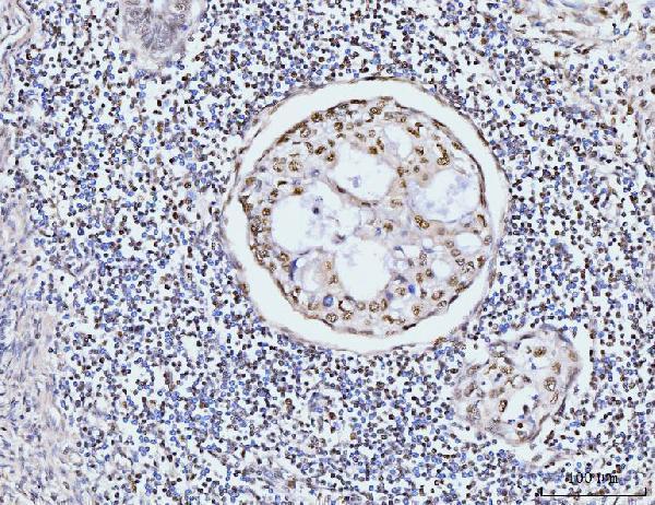 a05325 1 kifc1 primary antibodies ihc testing 6