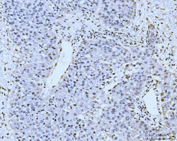 a05325 1 kifc1 primary antibodies ihc testing 7