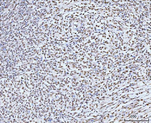 a05325 1 kifc1 primary antibodies ihc testing 8