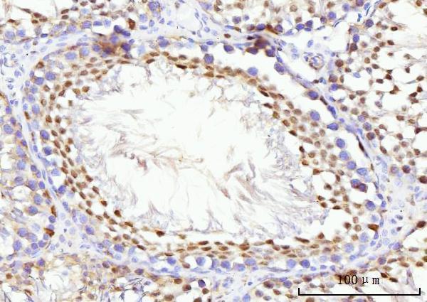 a05325 1 kifc1 primary antibodies ihc testing 9