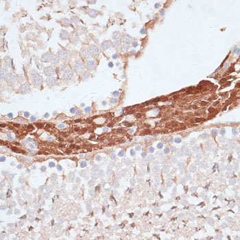 a05325 kifc1 primary antiboties ihc testing 2