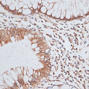 a05325 kifc1 primary antiboties ihc testing 3