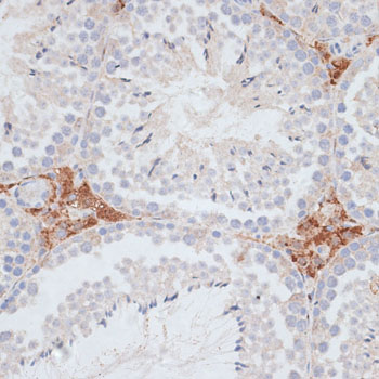 a05325 kifc1 primary antiboties ihc testing 4