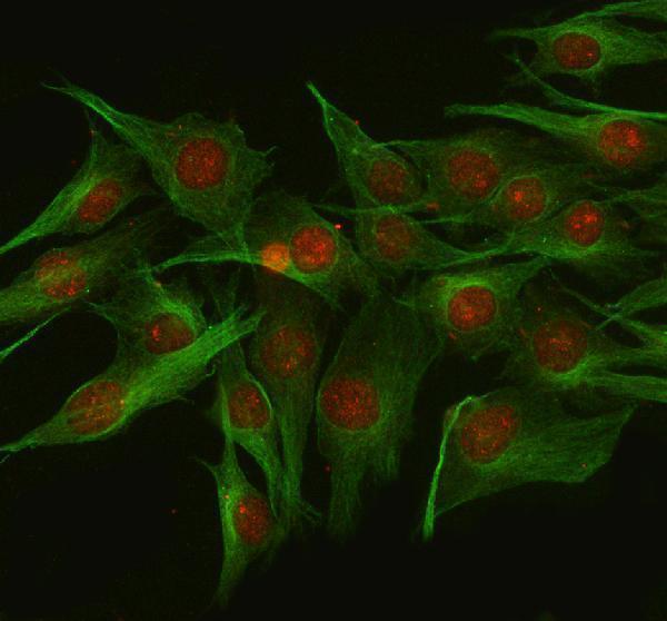  IF analysis of NUP133 using anti-NUP133 antibody (A05327-2) and anti-Beta Tubulin antibody (M01857-3)