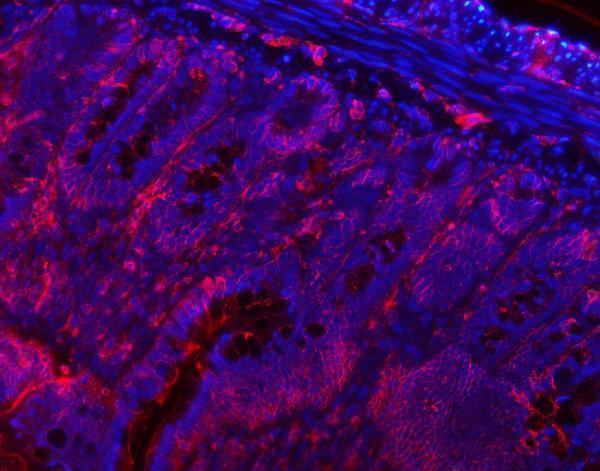 a05329 1 vapa primary antibodies if testing 10