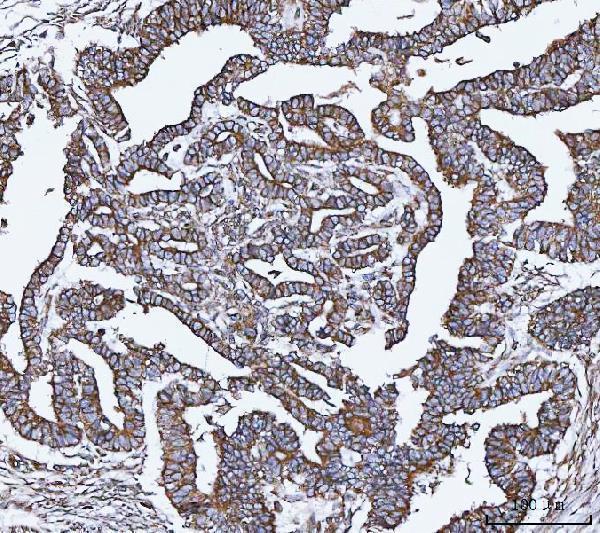 a05329 1 vapa primary antibodies ihc testing 2