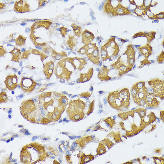 Immunohistochemistry of paraffin-embedded human stomach using VAPA antibody  at dilution of 1:100 
