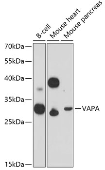 Western blot analysis of extracts of various cell lines, using VAPA Antibody  at 1:3000 dilution