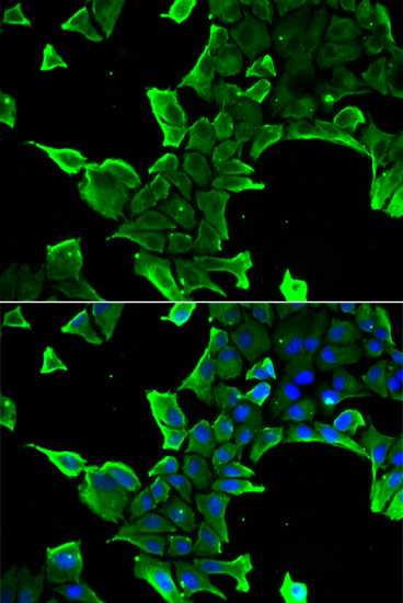 a05330 1 ncs1 primary antiboties if testing 2