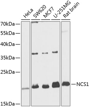 a05330 1 ncs1 primary antiboties wb testing 1