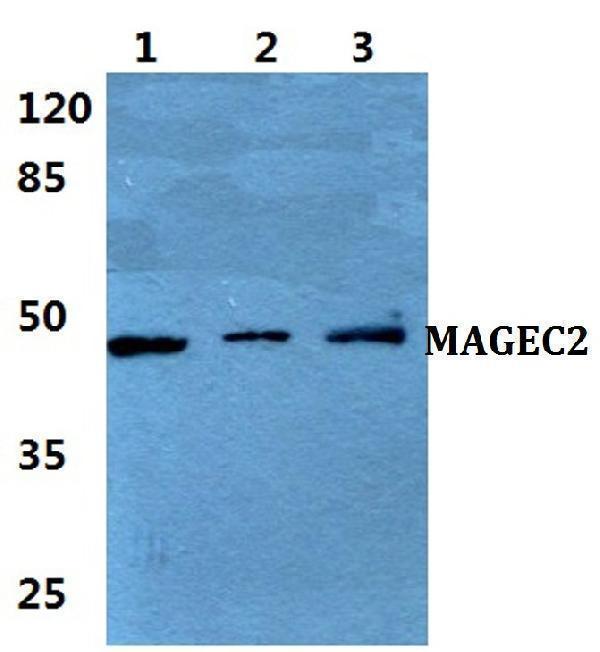 a05335 1 magec2 primary antiboties wb testing 1