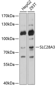 a05336 slc28a3 primary antiboties wb testing 1