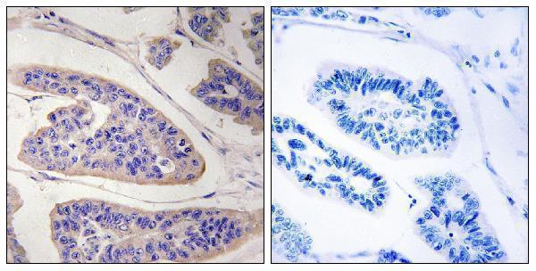 a05337 enah primary antibodies ihc testing 1