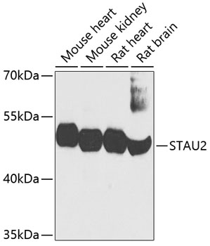 a05338 stau2 primary antiboties wb testing 1