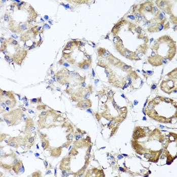 a05341 mgat1 primary antiboties if testing 2